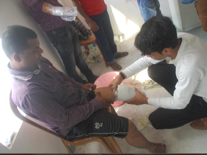 Measurement of Free artificial limbs and calipers