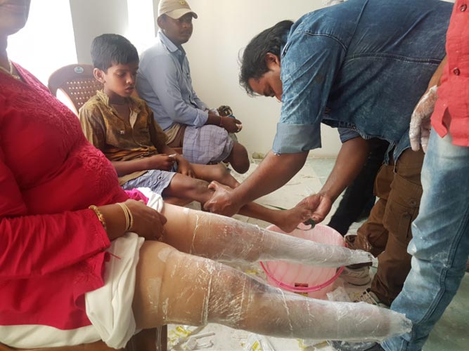 Measurement of Free artificial limbs and calipers